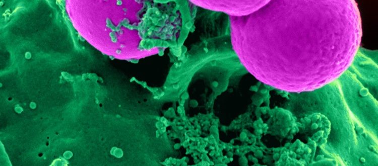 Avoid Image Manipulation